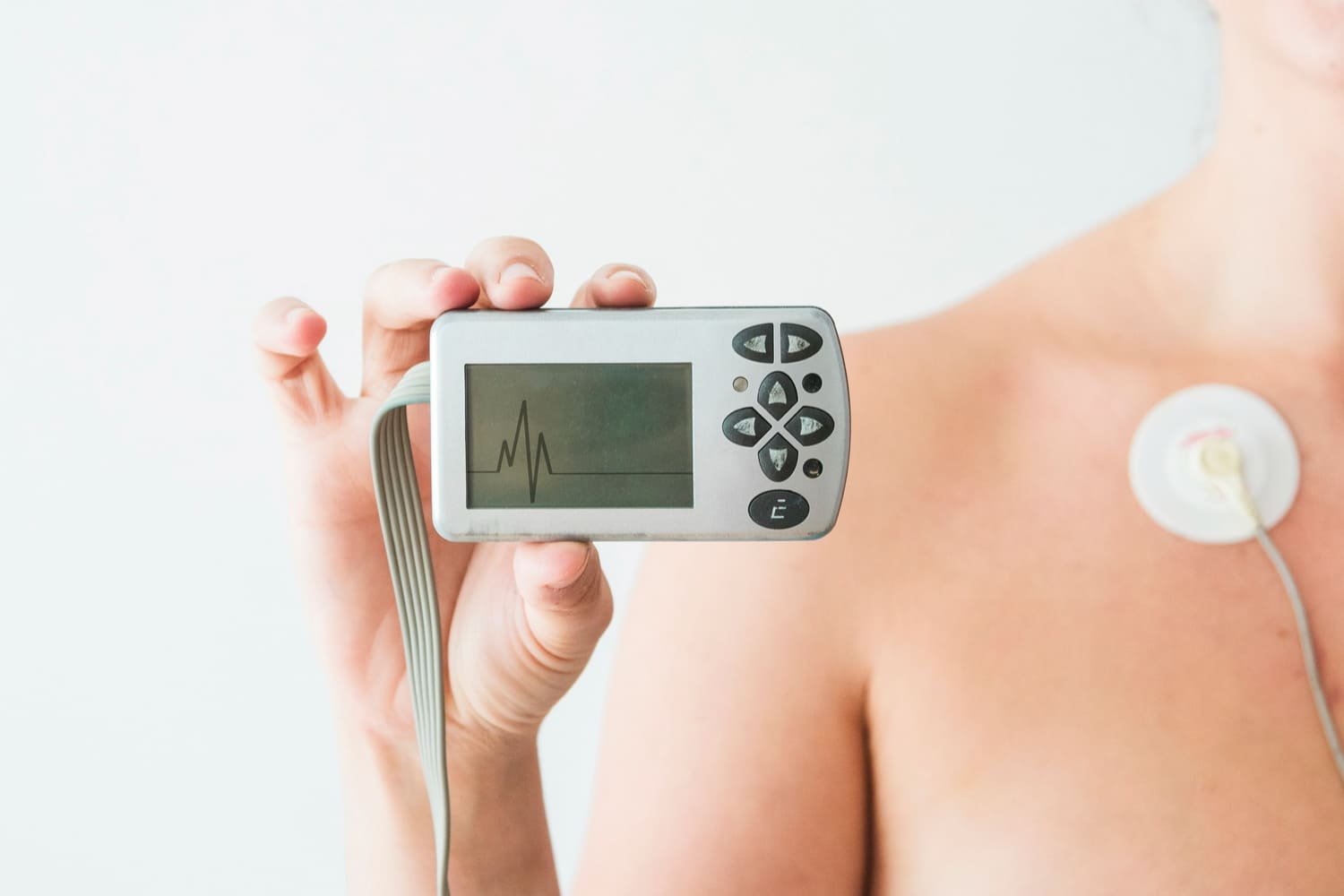 Estudio Holter del ritmo cardiaco 24 y 48 hrs